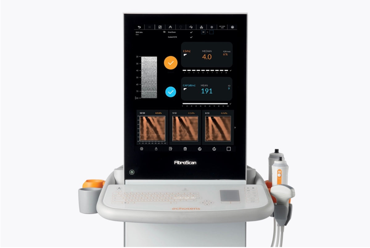 FibroScan